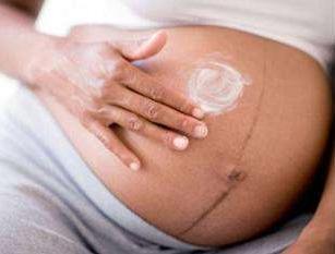 消除妊娠斑方法都有哪些